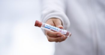 prueba coronavirus covid19