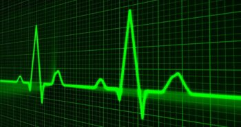 pulse-trace-gd2424671c_1280